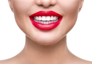 Are You A Candidate For Porcelain Veneers?