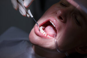 Cavity Prevention And Tooth Protection