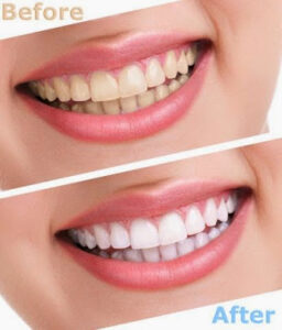 How Cosmetic Dentistry Can Help