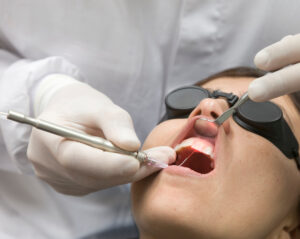 Laser Dentistry