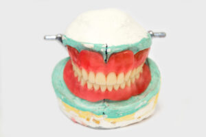 This And That About ValPlast Dentures