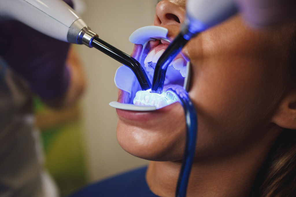 Modern Dental Technology, dental laser, at Island Dental Associates