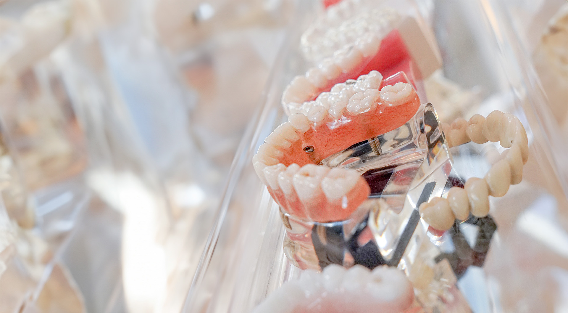 dentures at island dental associates