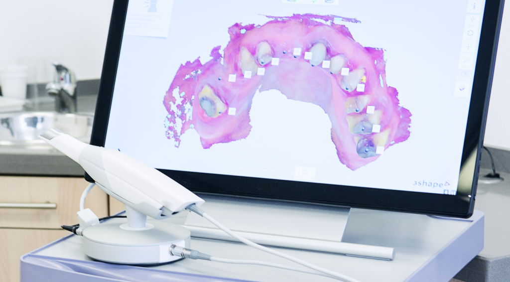 intraoral scanners / digital impressions at Island Dental Associates