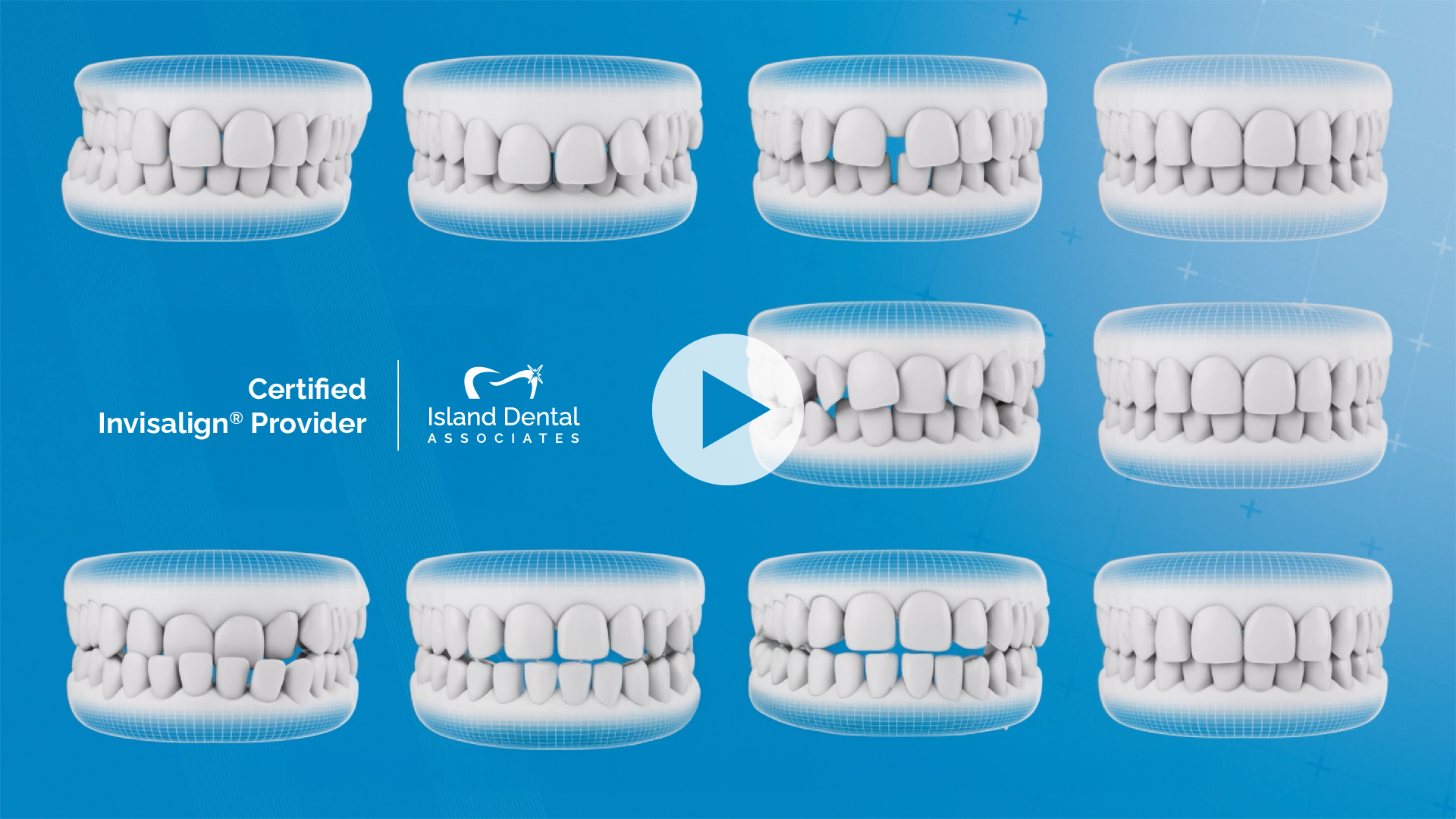 certified invisalign provider